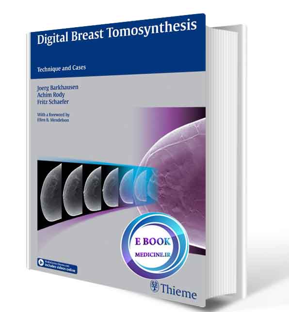 دانلود کتابDigital Breast Tomosynthesis: Technique and Cases(ORIGINAL PDF)